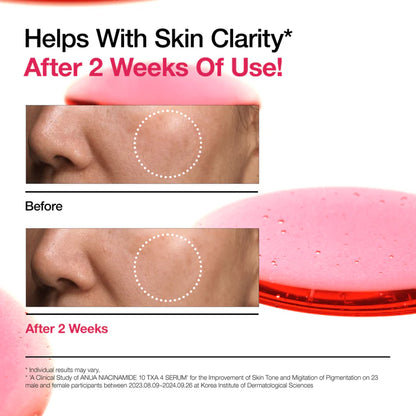 Niacinamide 10 TXA 4 Serum for Brightening and Dark Spots